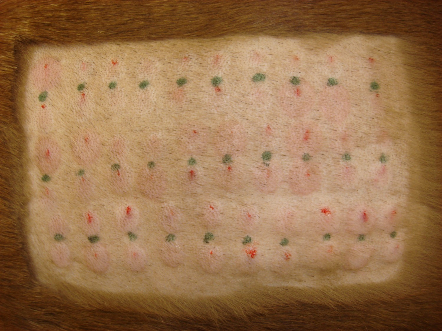 Intradermal Skin Testing 